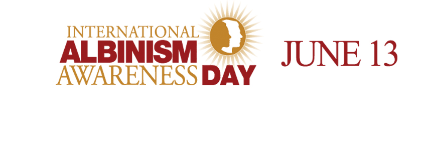 International Albinism Awareness Day